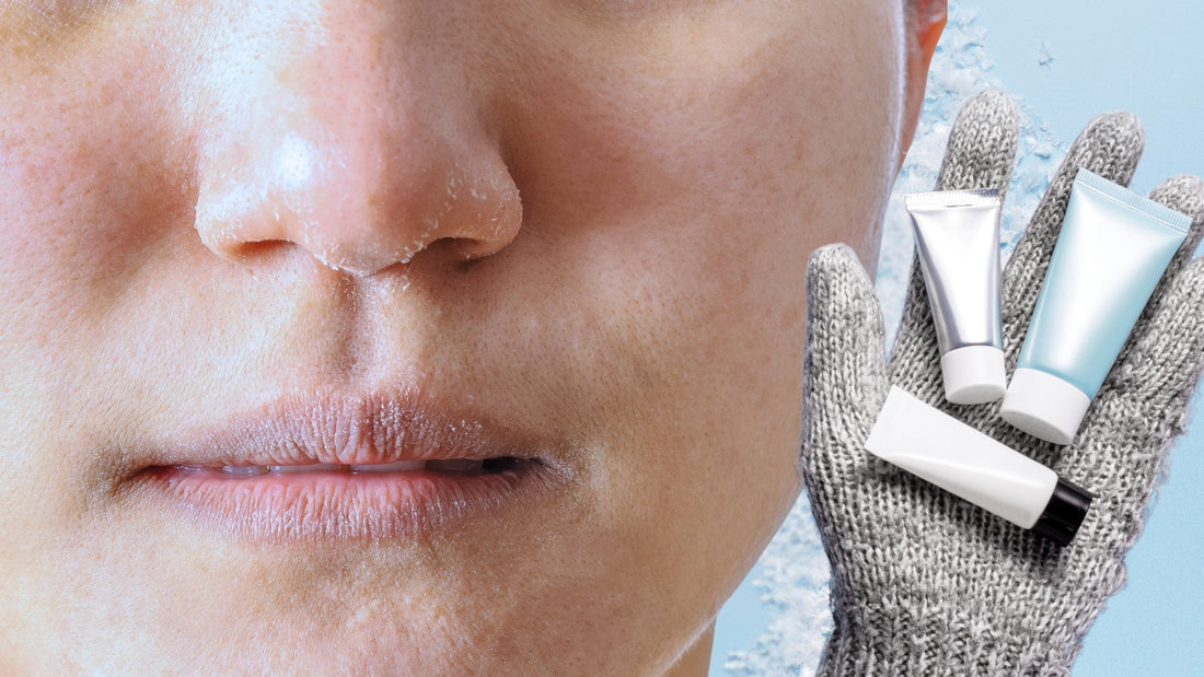 une femme avec la peau sèche à cause du froid avec un gant à côté 